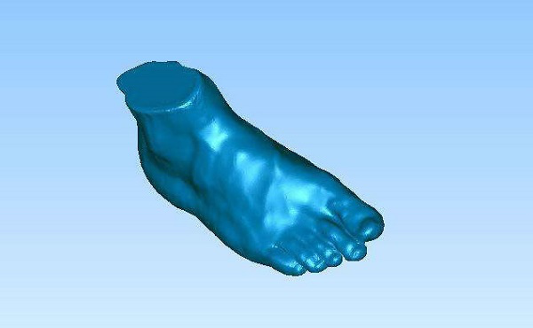 醫療3D打印機定制矯正器(圖4)