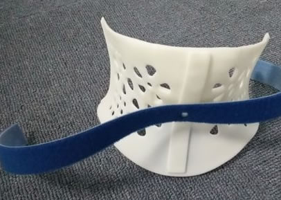 醫療3D打印機定制矯正器(圖2)