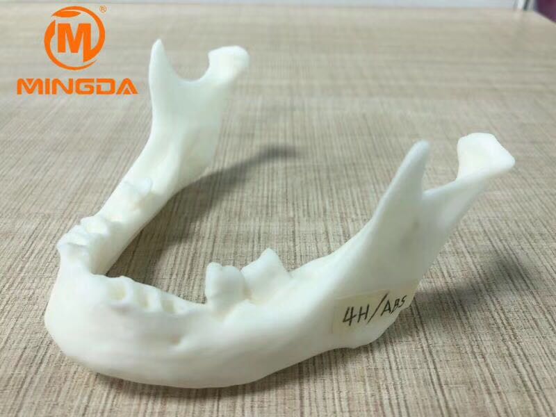 工業級3D打印機在牙科行業的應用(圖1)